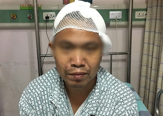 男子高處墜下險喪命，醫護同心化險情