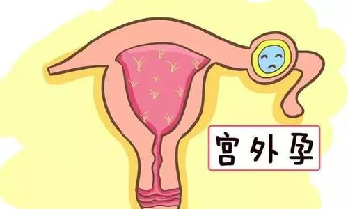 來月經腹痛？這可能是個“定時炸彈”！