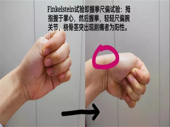 新手媽媽請注意！教你四招預防“媽媽手”