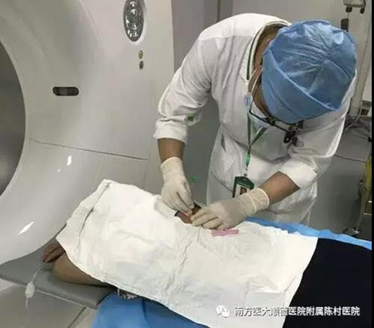 厲害！他們完成首例經皮穿刺肺活檢術！