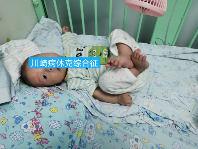 順德4月大嬰兒患上世界罕見病，救治全過程被還原
