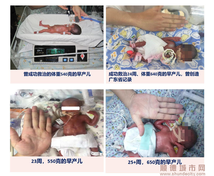 醫院成功救治多個極低體重早產兒.png