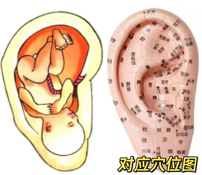 有一種痛叫“睡不著”，伍醫“耳穴壓豆”來支招！