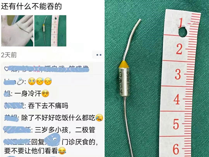 驚！3歲寶寶吞下了6厘米二極管，還好有他們