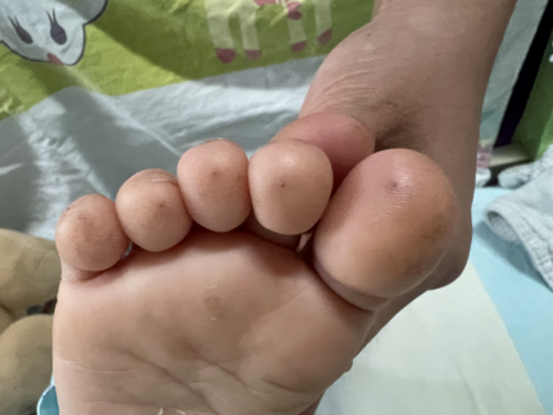 1歲女童被扎多個針眼驚呆醫(yī)生！這種“偏方”別再用了