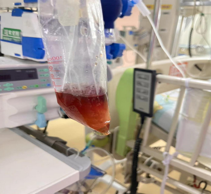 吃了一包零食，5歲娃進了ICU！這個病很多家長不知道