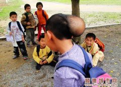 10歲男孩頭頂10厘米大瘤，貧困擋著治療路